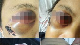 快訊 | 華潤(rùn)水泥分廠發(fā)生事故?。ǜ綀D）